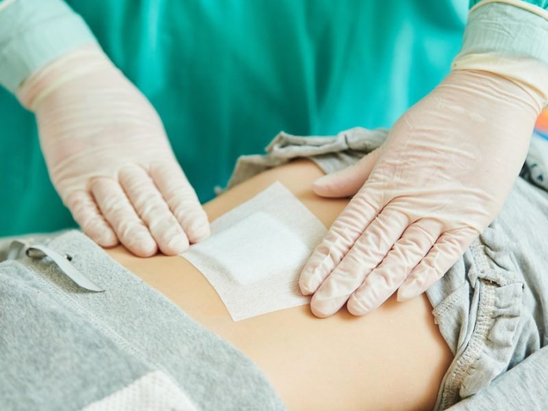 1920_stock-photo-surgeon-applies-bandage-on-wound-of-child-s-abdomen-1857176899